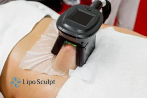 Are The Results From Aqualyx Permanent? 4 Compare Aqualyx Hatfield to other fat reduction treatments.