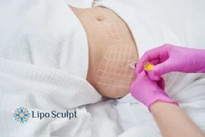 Are The Results From Aqualyx Permanent? 1 Do you want to know how long Aqualyx Hatfield results last?