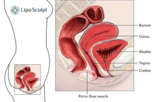 Treatment For A Leaky Bladder 2 How EM Chair treatment Hatfield can help Leaky bladder issues. Read more now!