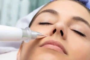 Best Actinic Keratoses Removal 3 Actinic keratoses Hatfield solutions - book in today!