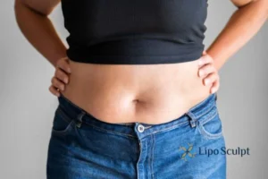 Bidding Farewell to Muffin Tops with Aqualyx Fat Injections 2 Do you wish you could reduce your muffin top Hatfield With Aqualy fat dissolving injections you can!